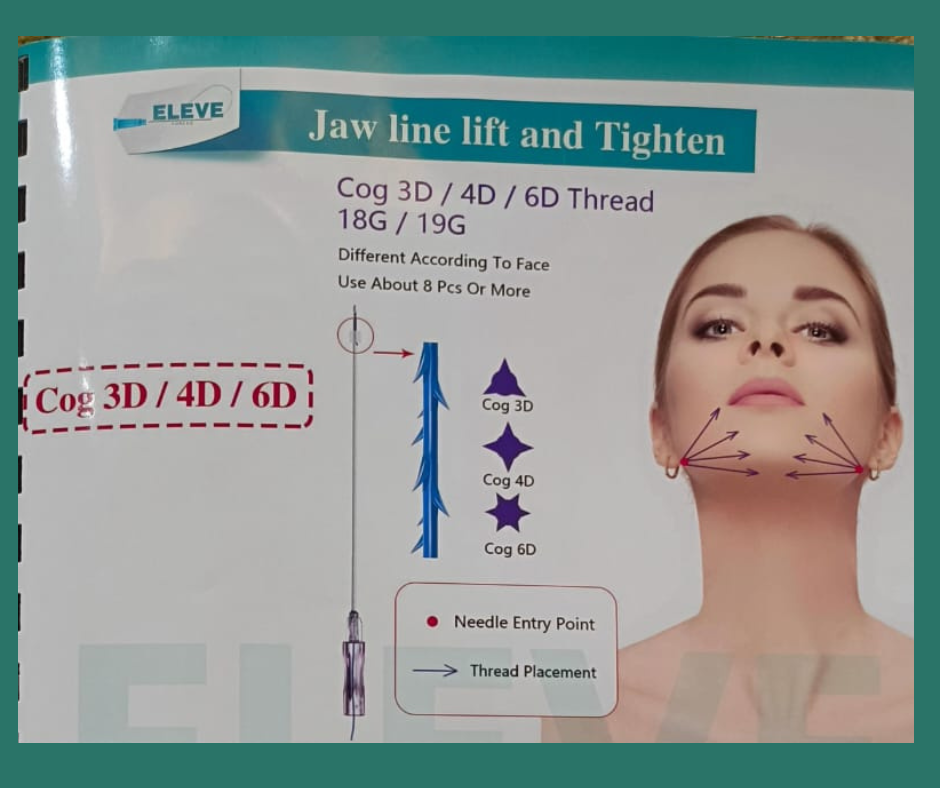 PCL COG 4D Lift Threads – Face & Body Lift (18G/19G/21G) | 10pcs Pack- Korea