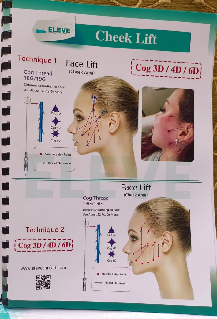 PCL COG 4D Lift Threads – Face & Body Lift (18G/19G/21G) | 10pcs Pack- Korea