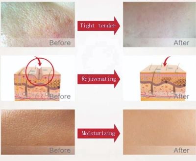 Anti aging and Anti Fine lines Skin Care Essence CAUTISSA Serum